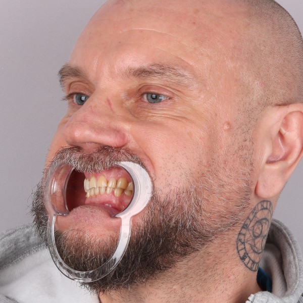 Przed profil prawy