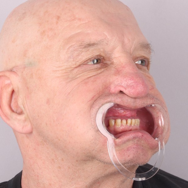 Przed profil lewy