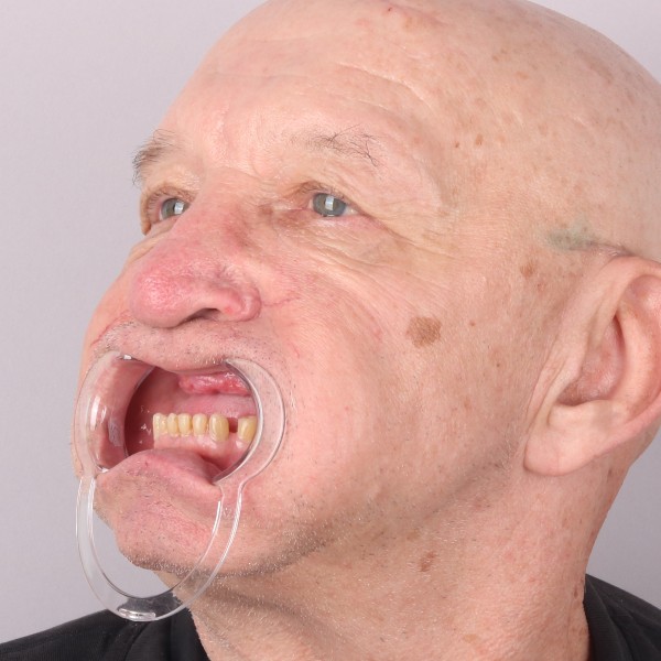 Przed profil prawy