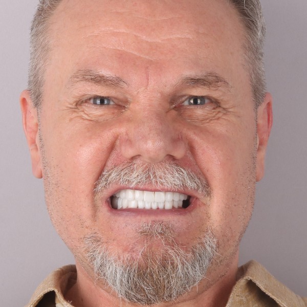 Witold Po Zabiegu