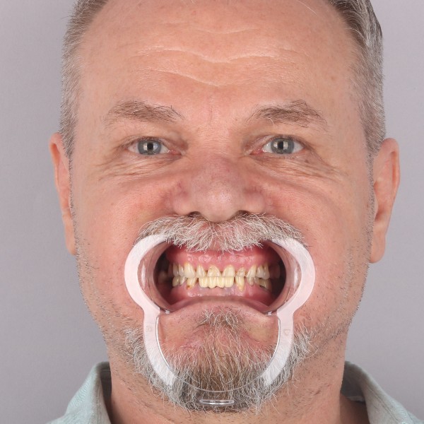 Przed przód