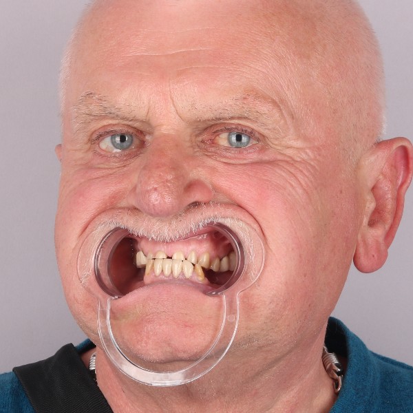 Przed profil prawy