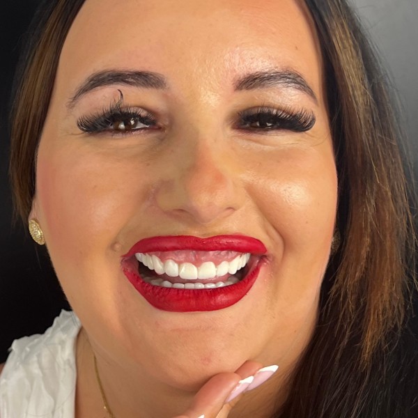 Ewelina Po Zabiegu