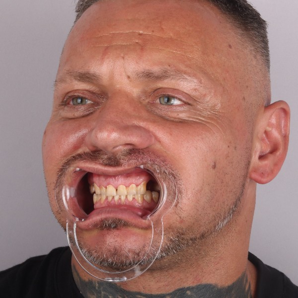 Przed profil prawy