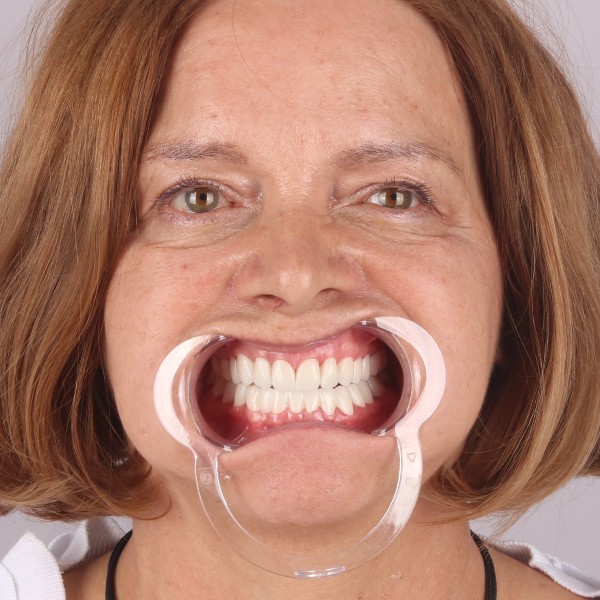 Po profil prawy