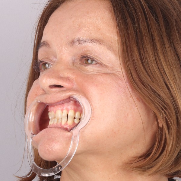 Przed profil prawy