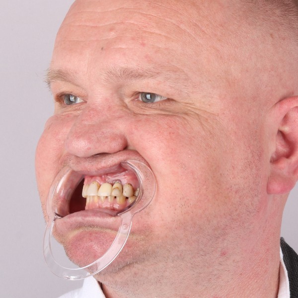 Przed profil prawy