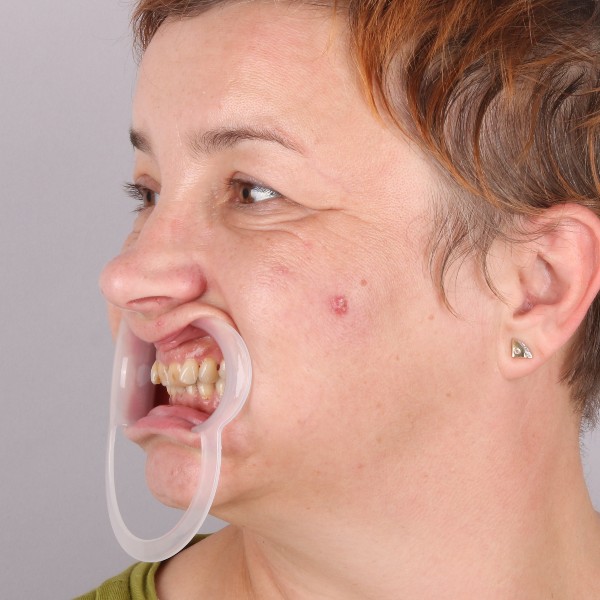 Przed profil prawy