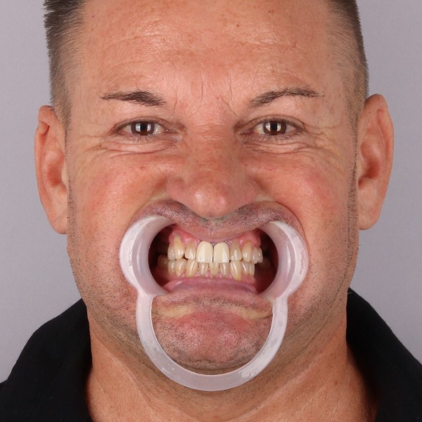 Przed przód