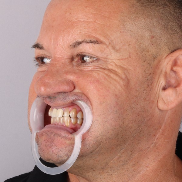 Przed profil prawy