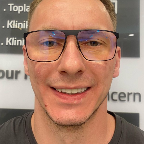 Tomasz Po Zabiegu