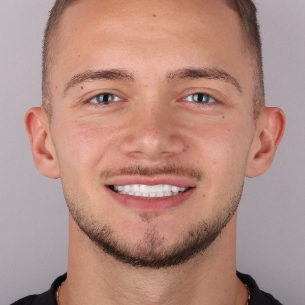 Paweł Po Zabiegu