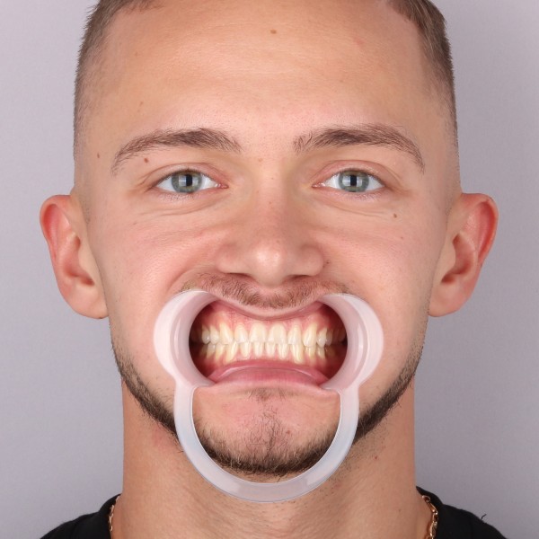 Przed przód