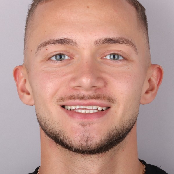 Paweł Przed Zabiegiem