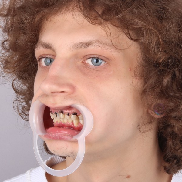 Przed profil prawy