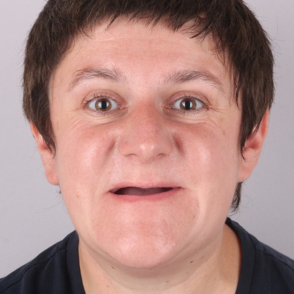 Przed przód