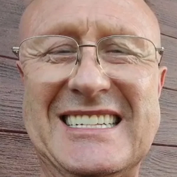 Dariusz, uśmiech po leczeniu w Turcji
