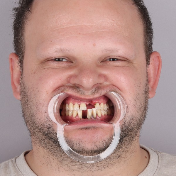 Przed przód