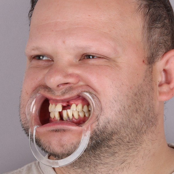 Przed profil prawy